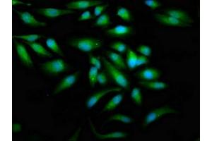 Immunofluorescence staining of Hela cells with ABIN7177987 at 1:100, counter-stained with DAPI. (ZAP7 (AA 253-325) 抗体)
