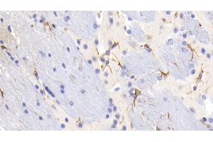Detection of GFAP in Mouse Cerebrum Tissue using Monoclonal Antibody to Glial Fibrillary Acidic Protein (GFAP) (GFAP 抗体  (AA 70-374))