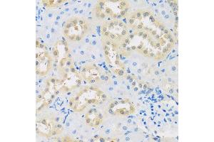 Immunohistochemistry of paraffin-embedded rat kidney using LETMD1 antibody at dilution of 1:100 (x40 lens). (LETMD1 抗体)