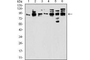 Western blot analysis using DDX20 mouse mAb against Jurkat (1), Hela (2), NTERA-2 (3), HL7702 (4), K562 (5), and C6 (6) cell lysate.
