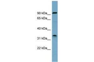 Image no. 1 for anti-serine Dehydratase (SDS) (AA 215-264) antibody (ABIN6743072) (serine Dehydratase 抗体  (AA 215-264))