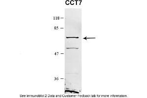 Sample Type: HEK 293 (10ug)Primary Dilution: 1:1000Secondary Antibody: conjugated goat anti-rabbitSecondary Dilution: 1:10,000Image Submitted By: Amy GrayBrigham Young University (CCT7 抗体  (Middle Region))