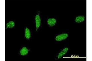 Immunofluorescence of monoclonal antibody to TOPORS on HeLa cell. (TOPORS 抗体  (AA 98-205))