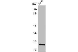 Western Blot analysis of HuvEc cells using TNF-IP 8 Polyclonal Antibody (TNFAIP8 抗体  (Internal Region))
