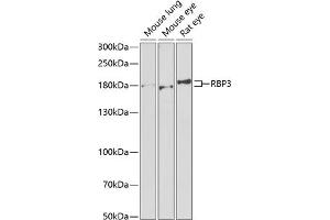 Western blot analysis of extracts of various cell lines, using RBP3 antibody (ABIN6129600, ABIN6146801, ABIN6146802 and ABIN6222034) at 1:1000 dilution. (RBP3 抗体  (AA 18-320))