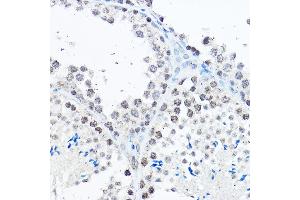 Immunohistochemistry (IHC) image for anti-Sp1 Transcription Factor (SP1) (AA 420-620) antibody (ABIN7270506)