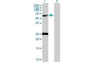 Western Blot analysis of NUCB1 expression in transfected 293T cell line by NUCB1 MaxPab polyclonal antibody. (Nucleobindin 1 抗体  (AA 1-461))