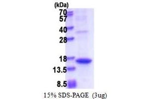 SDS-PAGE (SDS) image for Angiogenin (ANG) (AA 25-147) protein (His tag) (ABIN5853604) (ANG Protein (AA 25-147) (His tag))