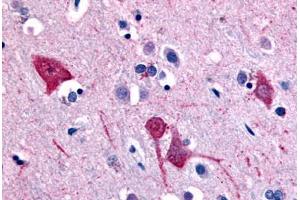 Immunohistochemistry (Paraffin-embedded Sections) (IHC (p)) image for anti-Solute Carrier Family 5 (Sodium/inositol Cotransporter), Member 11 (SLC5A11) (Extracellular Domain) antibody (ABIN213394)