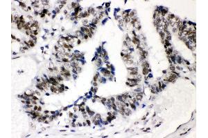 Immunohistochemistry (IHC) image for anti-Sp3 Transcription Factor (Sp3) (AA 569-599), (C-Term) antibody (ABIN3043350)