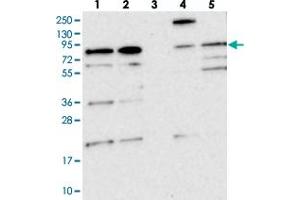 Western blot analysis of Lane 1: RT-4, Lane 2: U-251 MG, Lane 3: Human Plasma, Lane 4: Liver, Lane 5: Tonsil with KIAA1731 polyclonal antibody  at 1:250-1:500 dilution. (KIAA1731 (KIAA1731) 抗体)