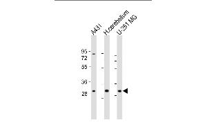 All lanes : Anti-BCDIN3D Antibody (C-Term) at 1:1000-2000 dilution Lane 1: A431 whole cell lysate Lane 2: human cerebellum lysate Lane 3: U-251 MG whole cell lysate Lysates/proteins at 20 μg per lane. (BCDIN3D 抗体  (AA 243-276))