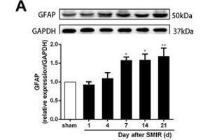 Astrocytes were activated and mainly expressed as the A1 phenotype in the spinal cord after SMIR. (GAPDH 抗体)