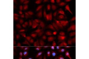 Immunofluorescence analysis of U2OS cells using PSMB5 Polyclonal Antibody