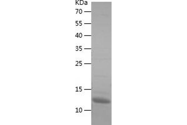 LAMC2 Protein (AA 1084-1193) (His tag)