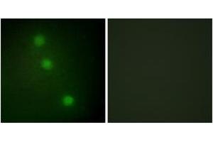Immunofluorescence analysis of HuvEc cells, using ATF1 Antibody. (AFT1 抗体  (AA 176-225))