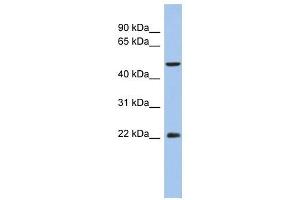 ANKH antibody used at 1 ug/ml to detect target protein.