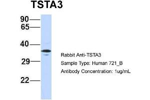Host: Rabbit Target Name: TSTA3 Sample Type: 721_B Antibody Dilution: 1. (TSTA3 抗体  (N-Term))