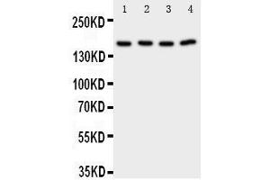 Anti-Phospholipase A2 antibody, Western blotting Lane 1: Rat Testis Tissue Lysate Lane 2: Rat Brain Tissue Lysate Lane 3: A549 Cell Lysate Lane 4: COLO320 Cell Lysate (PLA2G4A 抗体  (C-Term))