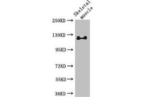 Western Blot Positive WB detected in: Mouse skeletal muscle tissue All lanes: RBL1 antibody at 3 μg/mL Secondary Goat polyclonal to rabbit IgG at 1/50000 dilution Predicted band size: 121, 115 kDa Observed band size: 121 kDa (p107 抗体  (AA 201-500))