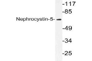 Western blot (WB) analysis of Nephrocystin-5 antibody in extracts from K562 cells. (IQCB1 抗体)
