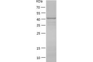 Western Blotting (WB) image for KIN, Antigenic Determinant of RecA Protein Homolog (KIN) (AA 1-393) protein (His tag) (ABIN7123689) (KIN Protein (AA 1-393) (His tag))