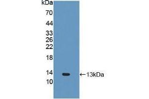 Western blot analysis of recombinant Human FNDC5. (FNDC5 抗体  (AA 77-144))