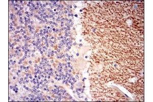 Immunohistochemical analysis of paraffin-embedded cerebellum tissues using GABBR2 mouse mAb with DAB staining. (GABBR2 抗体  (AA 319-483))