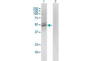 Western Blot analysis of ACMSD expression in transfected 293T cell line by ACMSD monoclonal antibody (M01), clone 3A9. (ACMSD 抗体  (AA 179-278))
