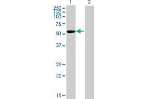 Western Blot analysis of IGSF21 expression in transfected 293T cell line by IGSF21 MaxPab polyclonal antibody. (IGSF21 抗体  (AA 1-467))