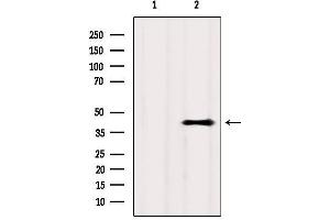 Western blot analysis of extracts from Hela, using GPR81 Antibody. (GPR81 抗体  (C-Term))
