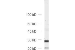 Western Blotting (WB) image for anti-Tumor Protein P63 Regulated 1-Like (TPRG1L) antibody (ABIN1742502) (TPRG1L 抗体)