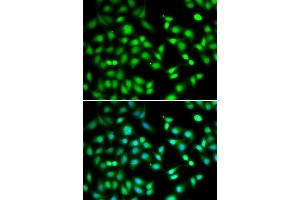 Immunofluorescence analysis of HeLa cells using CDKN2D antibody (ABIN5973935). (CDKN2D 抗体)