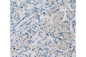 IHC-P analysis of stomach tissue, with DAB staining. (LOR 抗体  (AA 210-295))