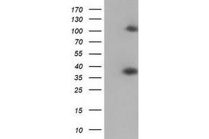 Western Blotting (WB) image for anti-Zinc Finger Protein 36, C3H Type, Homolog (Mouse) (ZFP36) antibody (ABIN1501404) (ZFP36 抗体)