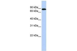Image no. 1 for anti-HIV-1 Tat Specific Factor 1 (HTATSF1) (AA 612-661) antibody (ABIN6744230) (HTATSF1 抗体  (AA 612-661))