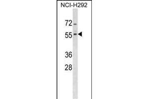 ZN Antibody (Center) (ABIN1537992 and ABIN2849203) western blot analysis in NCI- cell line lysates (35 μg/lane). (ZNF200 抗体  (AA 187-214))