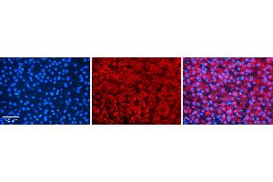 Rabbit Anti-TANK Antibody   Formalin Fixed Paraffin Embedded Tissue: Human Liver Tissue Observed Staining: Cytoplasm in hepatocytes Primary Antibody Concentration: N/A Other Working Concentrations: 1:600 Secondary Antibody: Donkey anti-Rabbit-Cy3 Secondary Antibody Concentration: 1:200 Magnification: 20X Exposure Time: 0. (TANK 抗体  (N-Term))