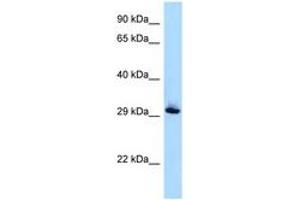 Image no. 1 for anti-RAB33B, Member RAS Oncogene Family (RAB33B) (AA 80-129) antibody (ABIN6747936) (RAB33B 抗体  (AA 80-129))
