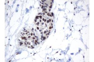 Image no. 1 for anti-Methyltransferase Like 16 (METTL16) antibody (ABIN1499432) (METTL16 抗体)