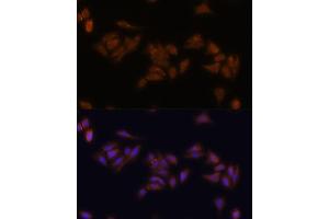 Immunofluorescence analysis of U-2 OS cells using RPS17 antibody (ABIN7270016) at dilution of 1:100. (RPS17 抗体  (AA 1-100))
