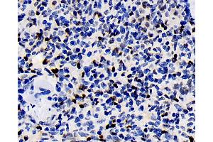 Immunohistochemistry analysis of paraffin-embedded rat spleen using ERK 2 Polyclonal Antibody at dilution of 1:100. (ERK2 抗体)