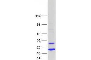 Western Blotting (WB) image for Peroxiredoxin 5 (PRDX5) (Transcript Variant 3) protein (Myc-DYKDDDDK Tag) (ABIN2728711)