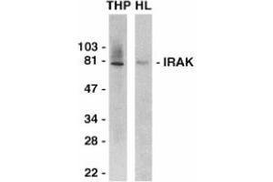 Image no. 1 for anti-Interleukin-1 Receptor-Associated Kinase 1 (IRAK1) (C-Term) antibody (ABIN201163) (IRAK1 抗体  (C-Term))
