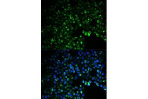 Immunofluorescence analysis of HeLa cells using UGDH antibody. (UGDH 抗体  (AA 165-494))