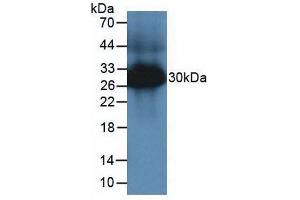 Western blot analysis of Mouse Large Intestine Tissue. (TPSAB1 抗体  (AA 149-273))