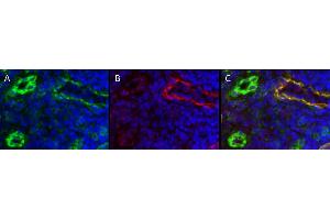 Immunohistochemistry detection of endogenous LYVE-1 in cryo sections of human colon carcinoma using anti-LYVE-1 (human), pAb  (red) and anti-human CD31 pAb (green). (LYVE1 抗体  (AA 24-232))