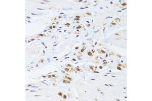 Immunohistochemistry of paraffin-embedded human stomach using GABPB1 Antibody. (GABPB1 抗体  (AA 231-395))