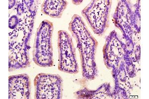 Paraformaldehyde-fixed, paraffin embedded Mouse small intestine, Antigen retrieval by boiling in sodium citrate buffer (pH6. (G Protein alpha S (AA 901-1037) 抗体)