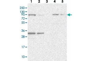 Western blot analysis of Lane 1: RT-4, Lane 2: U-251 MG, Lane 3: Human Plasma, Lane 4: Liver, Lane 5: Tonsil with FCHO2 polyclonal antibody . (FCHO2 抗体)